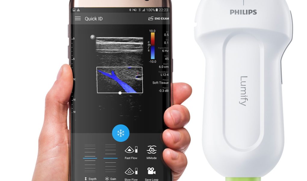 Philips Lumify – kompletne USG w smartfonie!